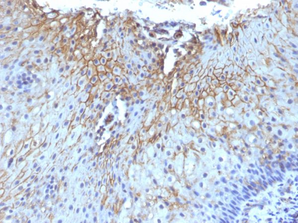 Formalin-fixed, paraffin-embedded human Tongue stained with CD59 Monoclonal Antibody (SPM616)
