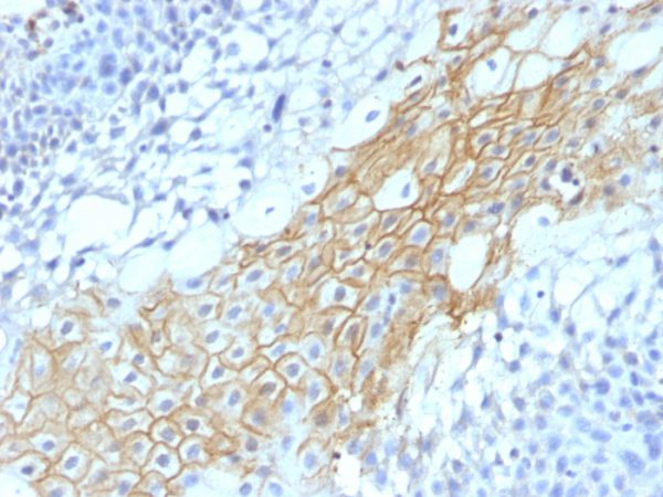 Formalin-fixed, paraffin-embedded human Tongue stained with CD59 Monoclonal Antibody (MACIF/1193)