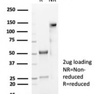 SDS-PAGE Analysis Purified CD59 Recombinant Rabbit Monoclonal Antibody (MACIF/7021R). Confirmation of Purity and Integrity of Antibody.