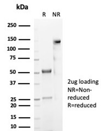 SDS-PAGE Analysis Purified CD59 Recombinant Rabbit Monoclonal Antibody (MACIF/7021R). Confirmation of Purity and Integrity of Antibody.