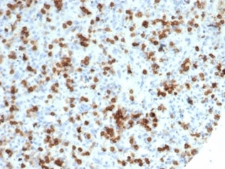 Formalin-fixed, paraffin-embedded human spleen stained with CD59 Recombinant Rabbit Monoclonal Antibody (MACIF/7021R). HIER: Tris/EDTA, pH9.0, 45min. 2 °: HRP-polymer, 30min. DAB, 5min.