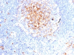Formalin-fixed, paraffin-embedded human tonsil stained with CD59 Recombinant Rabbit Monoclonal Antibody (MACIF/7021R). HIER: Tris/EDTA, pH9.0, 45min. 2 °: HRP-polymer, 30min. DAB, 5min.