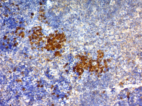 Formalin-fixed, paraffin-embedded mouse spleen stained with CD63 Mouse Monoclonal Antibody (NKI/C3) (DAB Chromogen)