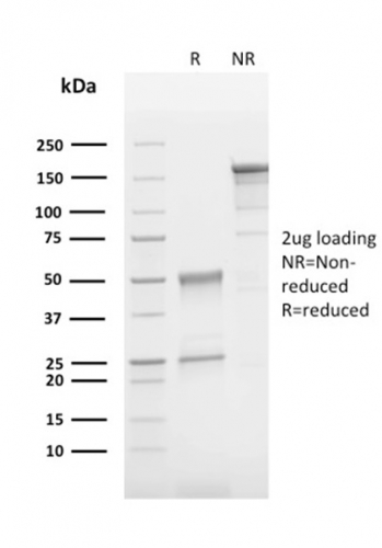 SDS-PAGE Analysis  Purified CD63 Mouse Monoclonal Antibody (LAMP3/2790). Confirmation of Integrity and Purity of Antibody.