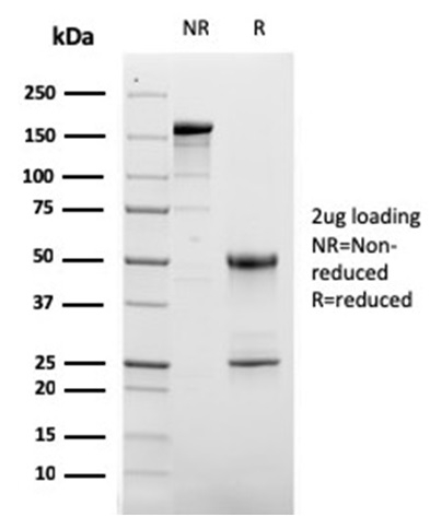 SDS-PAGE Analysis Puriifed CD63 Mouse Monoclonal Antibody (LAMP3/2881). Confirmation of Purity and Integrity of Antibody.