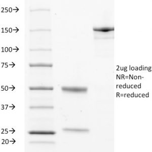 SDS-PAGE Analysis of Purified CD63 Mouse Monoclonal Antibody (529). Confirmation of Purity and Integrity of Antibody.