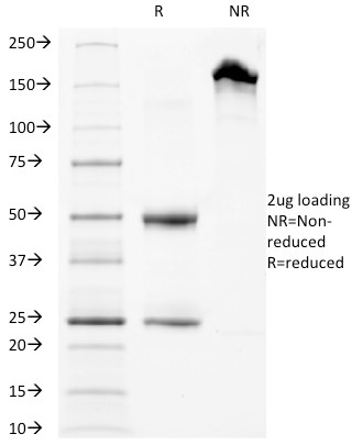 SDS-PAGE Analysis Purified CD63 Mouse Monoclonal Antibody (LAMP3/968). Confirmation of Purity and Integrity of Antibody