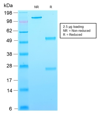 SDS-PAGE Analysis Purified CD63-Monospecific Mouse Recombinant Monoclonal Antibody (rMX-49.129.5). Confirmation of Purity and Integrity of Antibody.