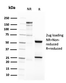SDS-PAGE Analysis Purified CD63 Mouse Recombinant Monoclonal Antibody (LAMP3/2788). Confirmation of Purity and Integrity of Antibody.