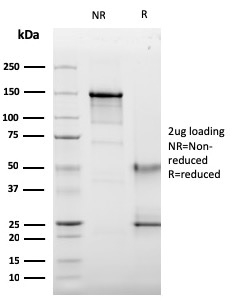 SDS-PAGE Analysis Purified CD63 Mouse Recombinant Monoclonal Antibody (LAMP3/2789). Confirmation of Purity and Integrity of Antibody.