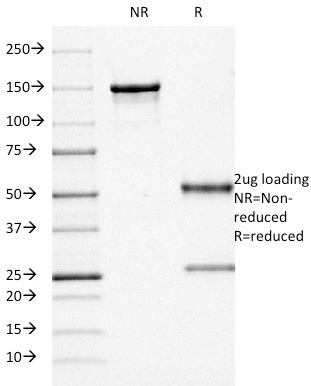 SDS-PAGE Analysis Purified CD68 Mouse Monoclonal Antibody (KP1). Confirmation of Purity and Integrity of Antibody.