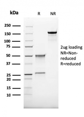 SDS-PAGE Analysis Purified CD68 Recombinant Mouse Monoclonal Antibody (rLAMP4/824). Confirmation of Purity and Integrity of Antibody.