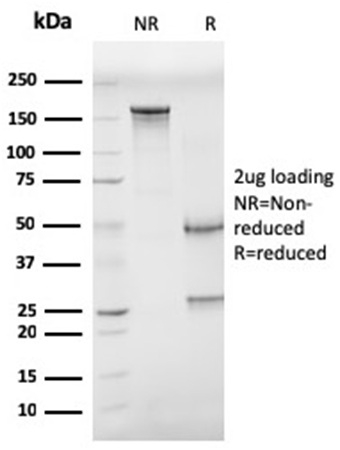 SDS-PAGE Analysis of Purified CD68 Mouse Monoclonal Antibody (CD68/G2). Confirmation of Integrity and Purity of Antibody.