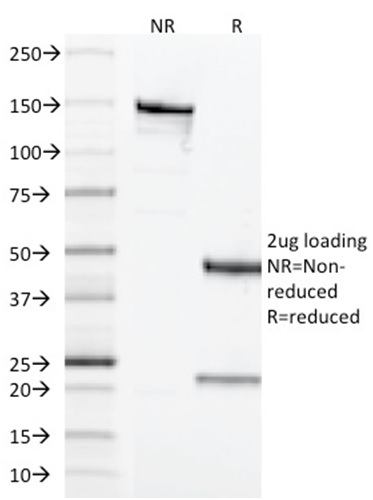 SDS-PAGE Analysis Purified CD68 Mouse Monoclonal Antibody (LAMP4/1830). Confirmation of Integrity and Purity of Antibody.