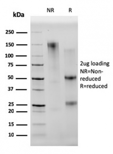 SDS-PAGE Analysis Purified CD68 Mouse Monoclonal Antibody (C68/2501). Confirmation of Integrity and Purity of Antibody.