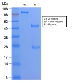 SDS-PAGE Analysis Purified CD68 Rabbit Recombinant Monoclonal Antibody (C68/2908R). Confirmation of Purity and Integrity of Antibody.