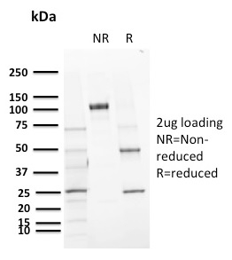 SDS-PAGE Analysis Purified CD72 Mouse Monoclonal Antibody (BU40). Confirmation of Purity and Integrity of Antibody.