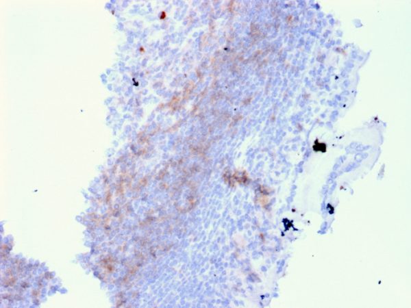 Formalin-fixed, paraffin-embedded human Lymph Node in Colon stained with CD72 Mouse Monoclonal Antibody (BU40).