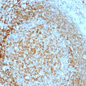 Formalin-fixed, paraffin-embedded human Tonsil stained with CD74 Mouse Monoclonal Antibody (LN-2).