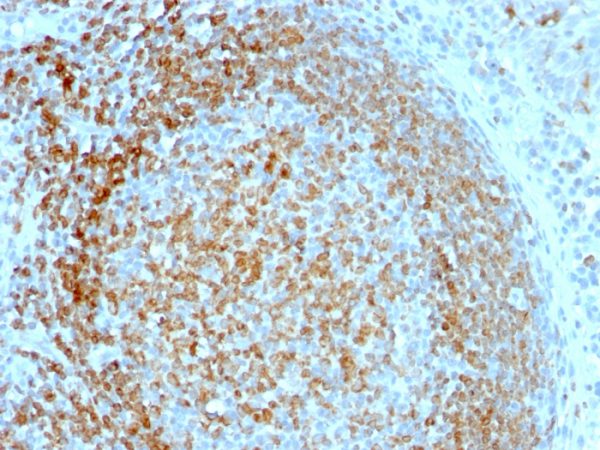 Formalin-fixed, paraffin-embedded human Tonsil stained with CD74 Mouse Monoclonal Antibody (LN-2).