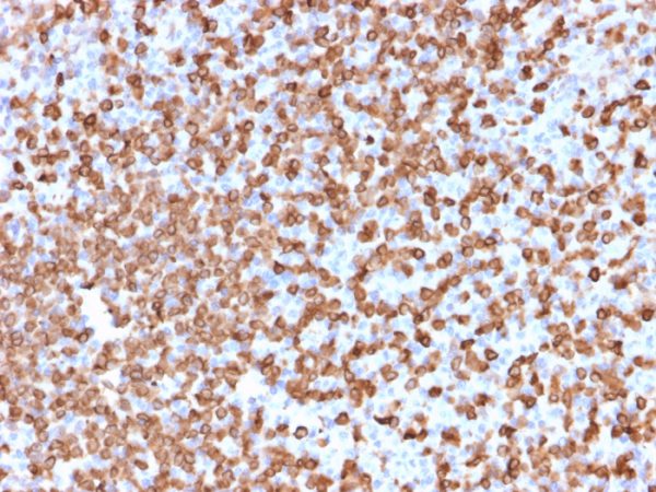 Formalin-fixed, paraffin-embedded human Spleen stained with CD74 Mouse Monoclonal Antibody (LN-2).