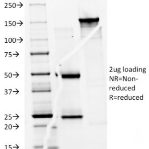 SDS-PAGE Analysis Purified CD74 Mouse Monoclonal Antibody (BU45). Confirmation of Purity and Integrity of Antibody.