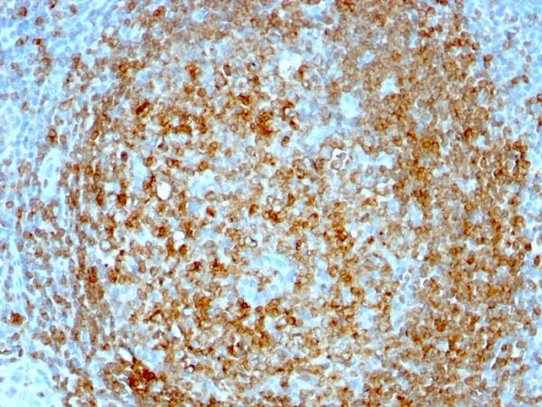 Formalin-fixed, paraffin-embedded human Tonsil stained with CD74 Mouse Monoclonal Antibody (CLIP/813).
