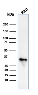 Western Blot Analysis of Raji cell lysate using CD74 Mouse Monoclonal Antibody (CLIP/813)