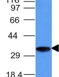 Western Blot Analysis of Raji cell lysate Using CD74 Monoclonal Antibody (CLIP/1133)