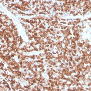 Formalin-fixed, paraffin-embedded human Tonsil stained with CD74 Recombinant Mouse Monoclonal Antibody (rCLIP/813).