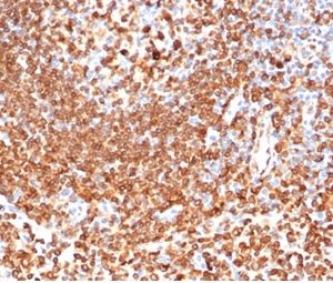 Formalin-fixed, paraffin-embedded human lymph node stained with CD74 Mouse Monoclonal Antibody (CLIP/6609) at 2ug/ml. HIER: Tris/EDTA, pH9.0, 45min. 2 °: HRP-polymer, 30min. DAB, 5min.
