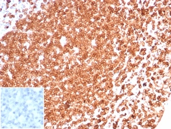 Formalin-fixed, paraffin-embedded human tonsil stained with CD74 Mouse Monoclonal Antibody (CLIP/6609) at 2ug/ml. Inset: PBS instead of primary antibody; secondary only negative control.