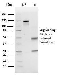 SDS-PAGE Analysis Purified CD74 Mouse Monoclonal Antibody (CLIP/6609). Confirmation of Purity and Integrity of Antibody.