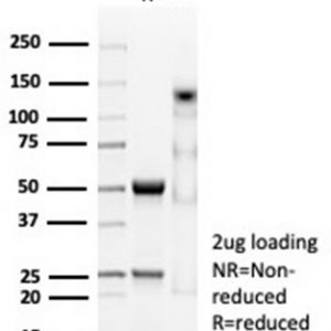 SDS-PAGE Analysis of Purified CD74 Recombinant Rabbit Monoclonal Antibody (CLIP/7023R). Confirmation of Purity and Integrity of Antibody.