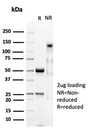 SDS-PAGE Analysis Purified CD74 Recombinant Rabbit Monoclonal Antibody (CLIP/7023R). Confirmation of Purity and Integrity of Antibody.