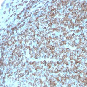 Formalin-fixed, paraffin-embedded human Tonsil stained with CD74 Recombinant Rabbit Monoclonal Antibody (CLIP/3127R).