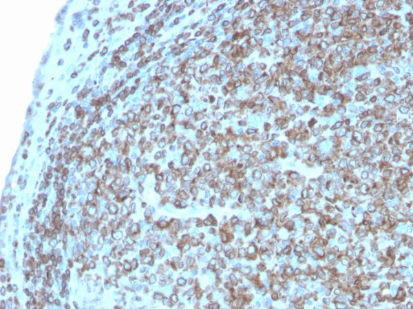 Formalin-fixed, paraffin-embedded human Tonsil stained with CD74 Recombinant Rabbit Monoclonal Antibody (CLIP/3127R).