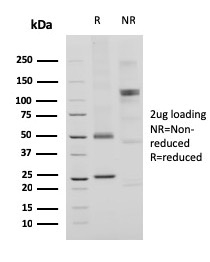 SDS-PAGE Analysis Purified CD74 Recombinant Rabbit Monoclonal Antibody (CLIP/3127R). Confirmation of Purity and Integrity of Antibody.