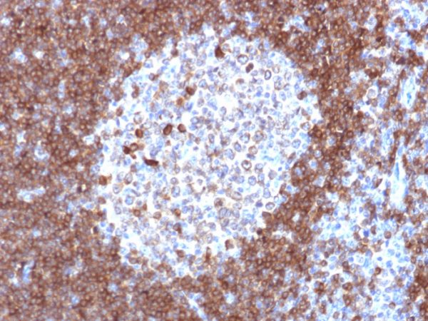 Formalin-fixed, paraffin-embedded human tonsil stained with CD79a Mouse Monoclonal Antibody (JCB117).