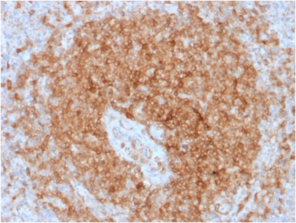 Formalin-fixed, paraffin-embedded human Spleen stained with CD79a Mouse Recombinant Monoclonal Antibody (rIGA/764).