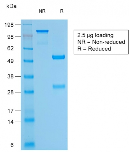 SDS-PAGE Analysis Purified CD79a Mouse Recombinant Monoclonal Antibody (rIGA/764). Confirmation of Purity and Integrity of Antibody