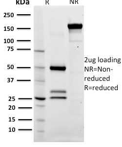 SDS-PAGE Analysis of Purified CD79a Mouse Monoclonal Antibody (ZL7-4). Confirmation of Integrity and Purity of Antibody.