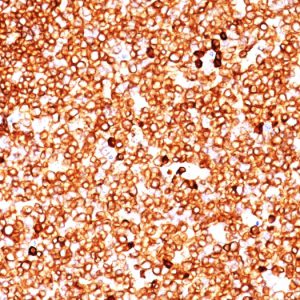 Formalin-fixed, paraffin-embedded human Tonsil stained with CD79a Monoclonal Antibody (SPM549)