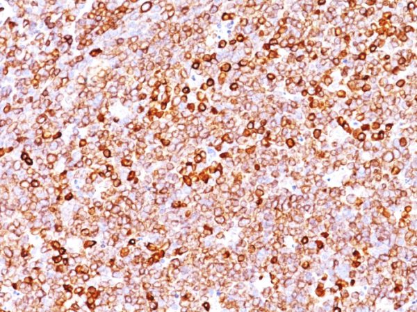 Formalin-fixed, paraffin-embedded human Tonsil stained with CD79a Mouse Monoclonal Antibody (JCB117 + HM47/A9).