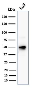 Western Blot Analysis of human Raji cell lysate using CD79a Mouse Monoclonal Antibody (JCB117 + HM47/A9).