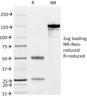 SDS-PAGE Analysis Purified CD79a Mouse Monoclonal Antibody (JCB117 + HM47/A9). Confirmation of Purity and Integrity of Antibody.