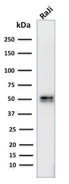 Western Blot Analysis of human Raji cell lysate using CD79a Mouse Monoclonal Antibody (IGA/764).