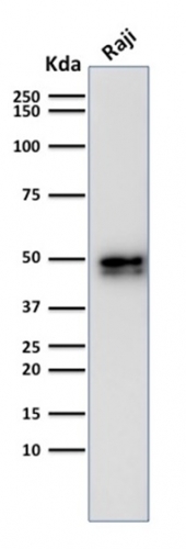 Western Blot Analysis of Raji cell lysate using CD79a Rabbit Recombinant Monoclonal Antibody (IGA/1790).