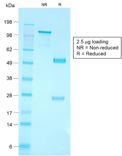 SDS-PAGE Analysis Purified CD79a Rabbit Recombinant Monoclonal Antibody (IGA/1790R). Confirmation of Purity and Integrity of Antibody.