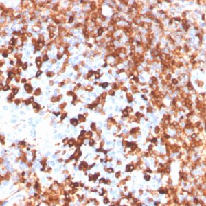Formalin-fixed, paraffin-embedded human tonsil stained with CD79a Rabbit Recombinant Monoclonal Antibody (IGA/3939R).